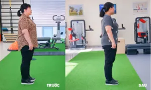 Giảm 10 kg sau gần ba tháng điều trị béo phì